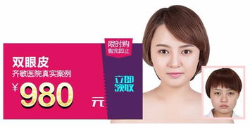 鞍山齊敏 980元雙眼皮手術，開啟美麗雙眸新篇章